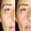Magic Serum Lift 2